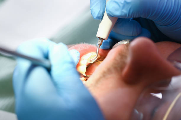 Best Broken or Chipped Tooth Repair in Ventnor City, NJ
