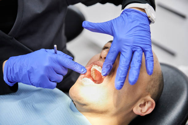 Best Knocked-Out Tooth (Avulsed Tooth) Treatment in Ventnor City, NJ
