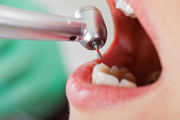 Best Emergency Treatment for Oral Infections in Ventnor City, NJ